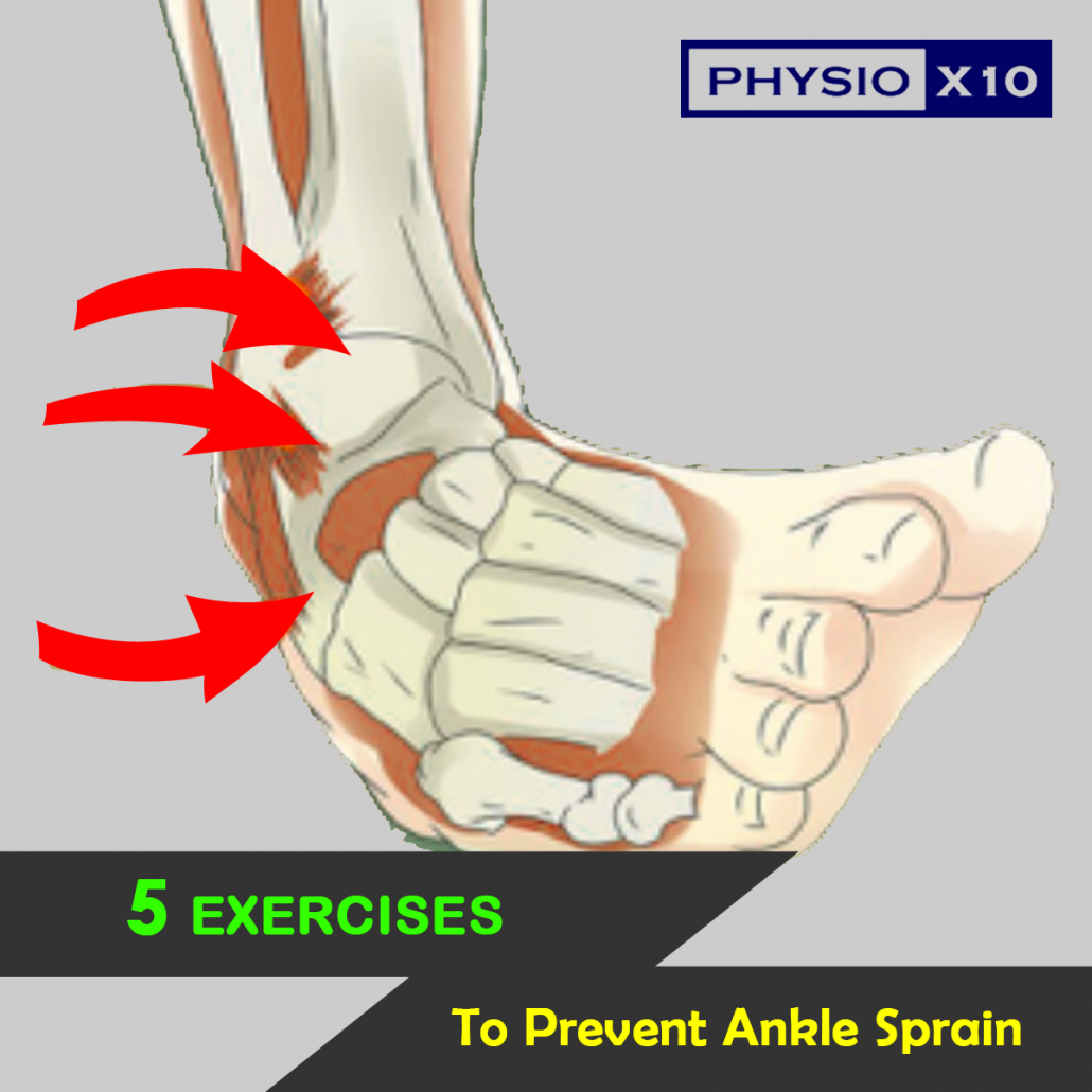 5 Strengthening Exercises To Prevent Ankle Sprain - PHYSIO X10